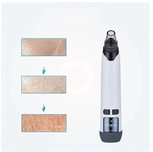 Blackhead Remover Vacuum Suction Trendverse Market